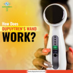 Profile picture of Dupuytrenecure